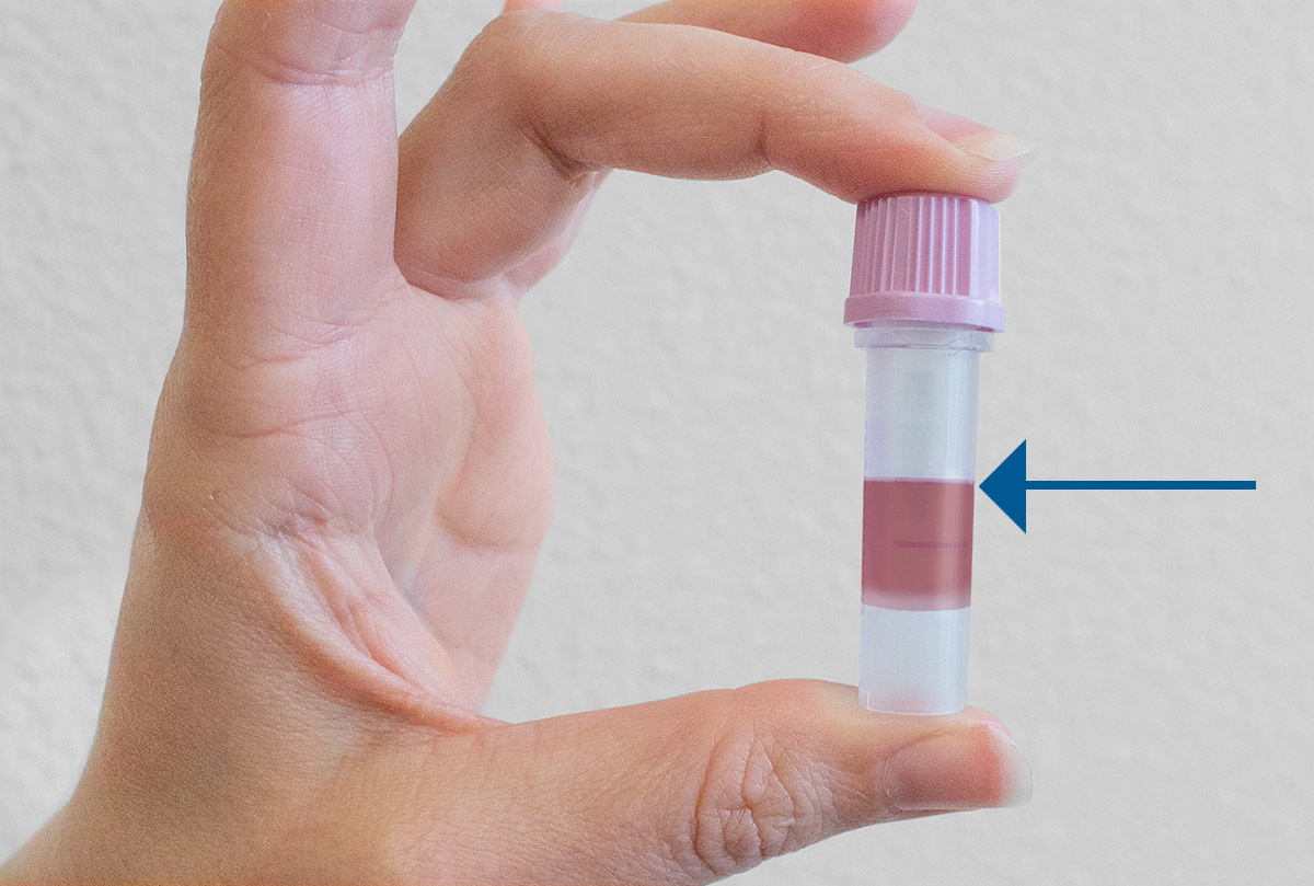 Specimen Collection Instructions