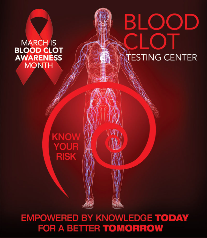 Know Your Risk for Blood Clot! » Laboratory Testing and Research